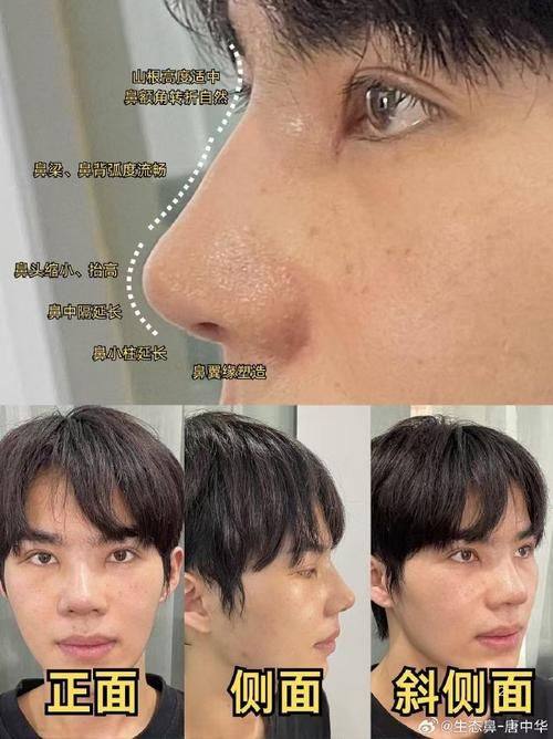 东莞罗恩医疗美容门诊是正规医院吗？