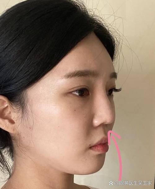 西安丽星美嘉儿医疗美容门诊部详细的预约挂号方式及流程