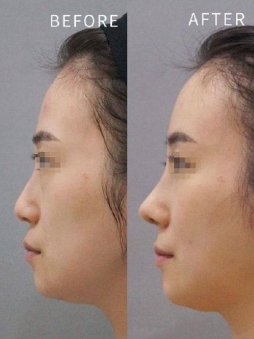 济南时逅整形医院真人口碑评价怎么样?