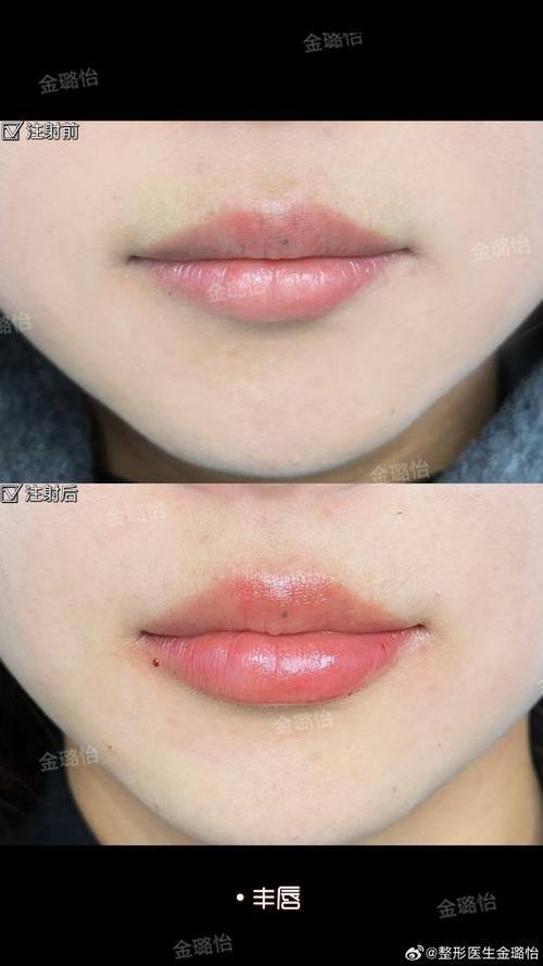 海南煌越植发医疗美容门诊部是正规医院吗？