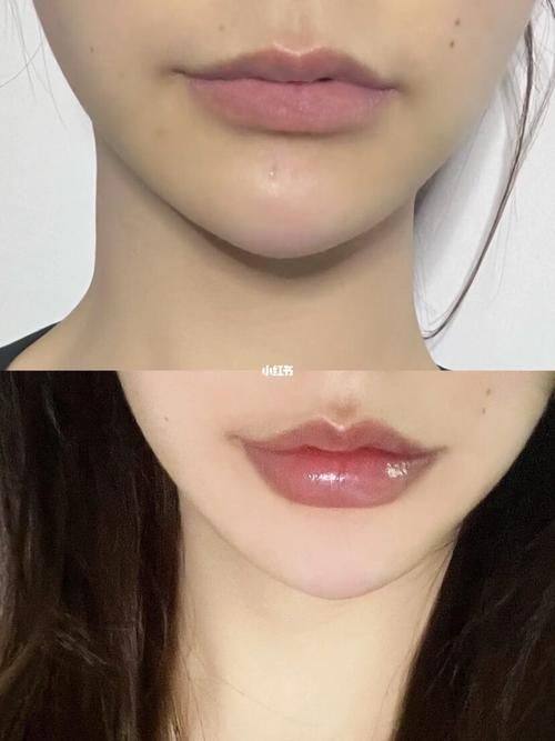 海南煌越植发医疗美容门诊部详细的预约挂号方式及流程