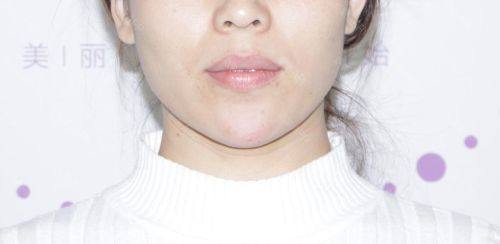 天津艾丽苏蔓医疗美容门诊部收费价格表/收费标准