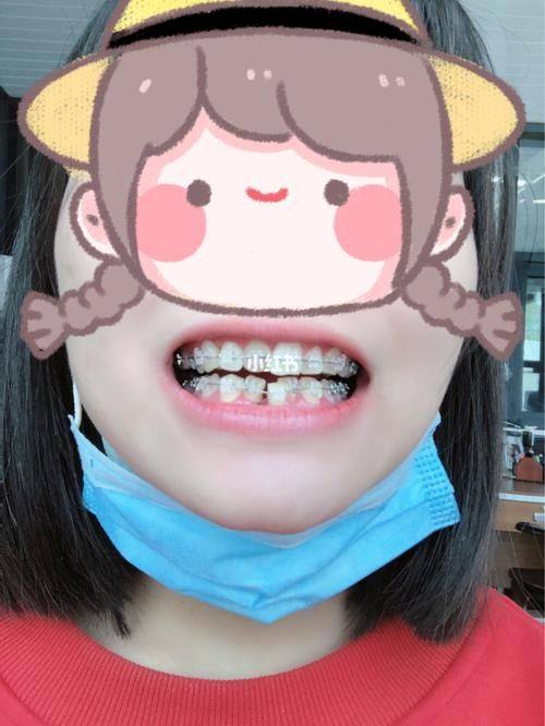 宜昌伍家岗福鑫口腔诊所真人口碑评价怎么样？