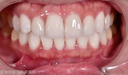 深圳鹏程口腔详细的预约挂号方式及流程