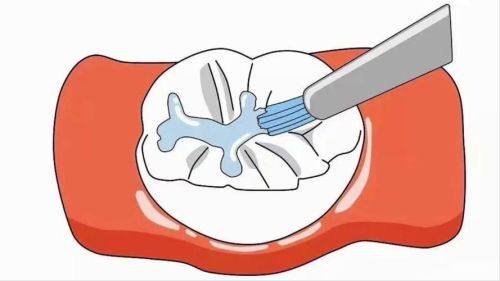 安徽马鞍山四叶草口腔收费价格表/收费标准