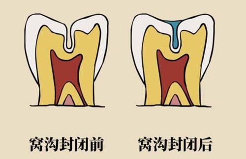贵阳一牙兔口腔（花果园店）详细的预约挂号方式及流程