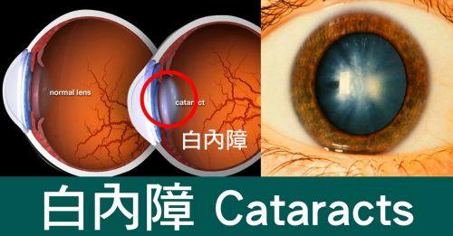 中山大学附属第六医院眼科详细的预约挂号方式及流程