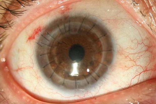 中山大学附属第六医院眼科医生团队实力强大及骨干医生简介