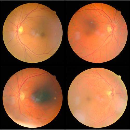 郑州大学附属第五医院眼科真人口碑评价怎么样?