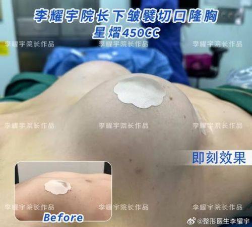 西安丽星美嘉儿医疗美容门诊部收费价格表/收费标准