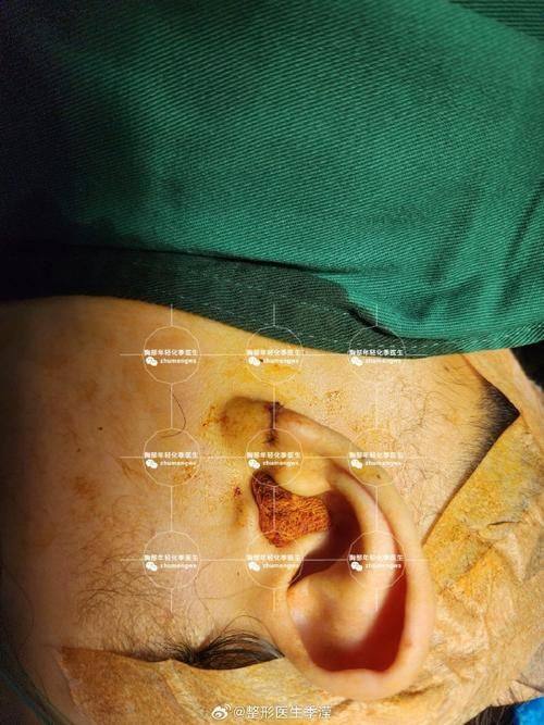 台州市中 心医院整形美容激光中 心真人口碑评价怎么样?