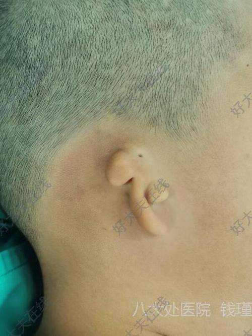 天津艾丽苏蔓医疗美容门诊部医生团队实力强大及骨干医生简介