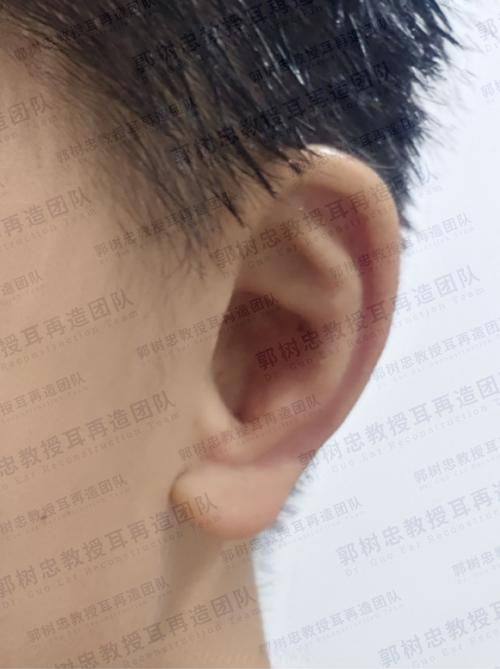 新疆塔城市优兰卡医疗美容门诊部详细的预约挂号方式及流程