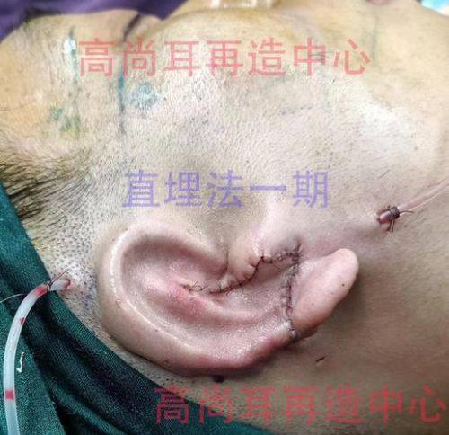 天津艾丽苏蔓医疗美容门诊部真人口碑评价怎么样?