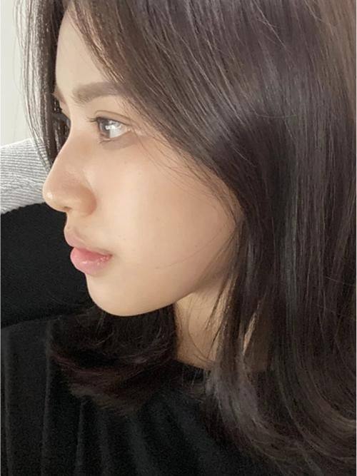 长沙嘉丽整形美容门诊部真人口碑评价怎么样？