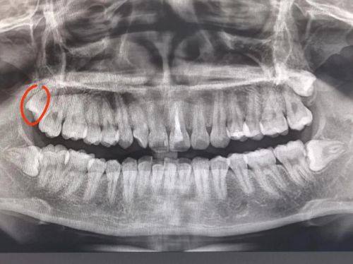 舟山吾同口腔真人口碑评价怎么样?