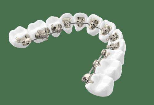 温州瑞安叶叔平口腔真人口碑评价怎么样?