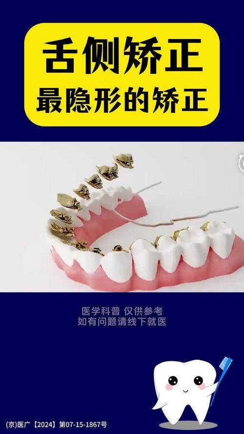 温州瑞安叶叔平口腔特色项目及技术优势