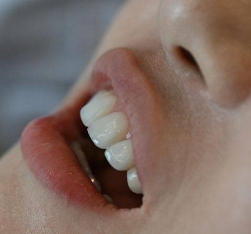 南宁兴宁牙贝尔口腔医院收费价格表/收费标准