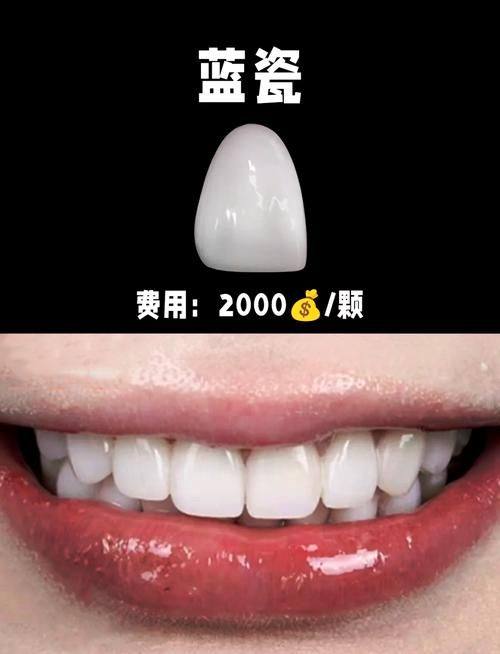 贵阳一牙兔口腔（花果园店）是正规医院吗？