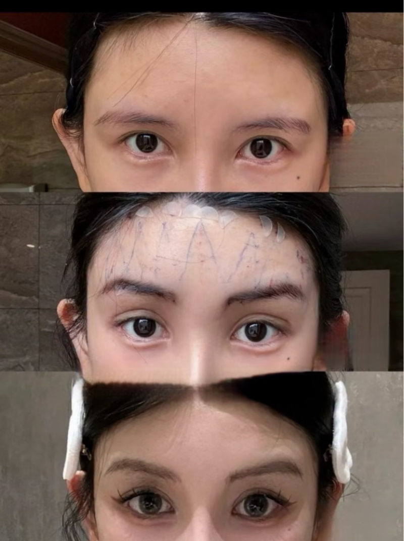 海南煌越植发医疗美容门诊部真人口碑评价怎么样？