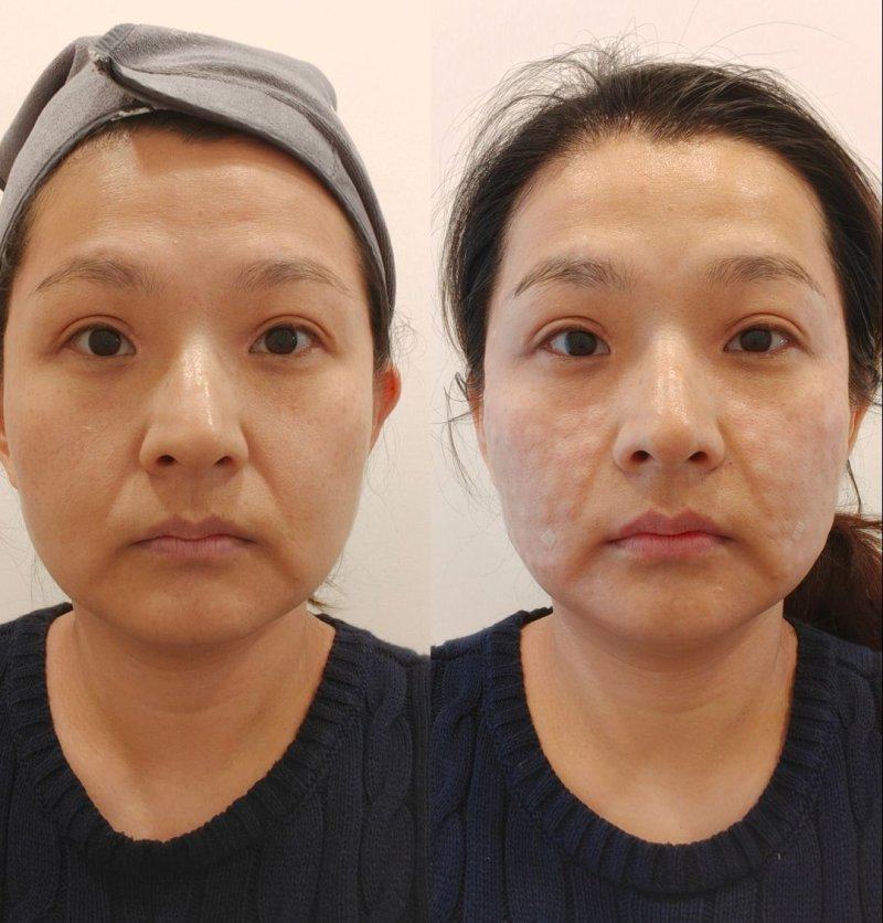 天津艾丽苏蔓医疗美容门诊部是正规医院吗?