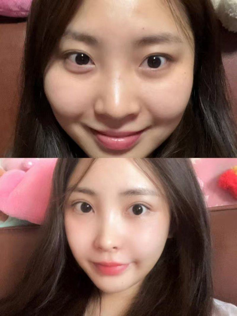 台州市中 心医院整形美容激光中 心是正规医院吗?