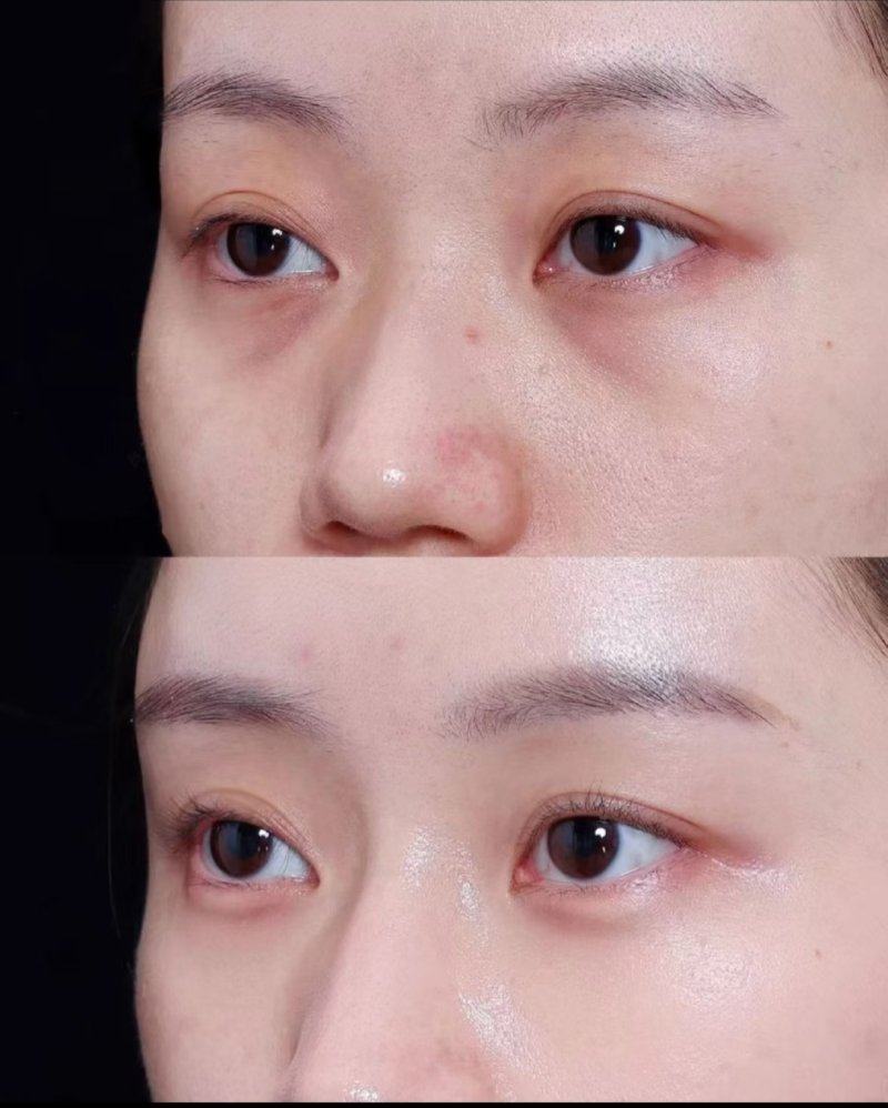 海南煌越植发医疗美容门诊部特色项目及技术优势