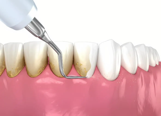 济南市口腔医院口腔修复科特色项目及技术优势