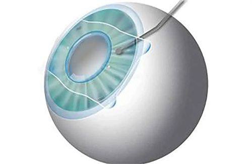 蔚鹏医生擅长项目