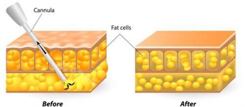 肖敬贞医生擅长项目