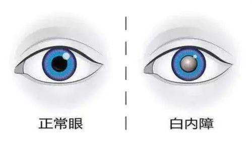 临沂润视眼科医院地址电话营业时间