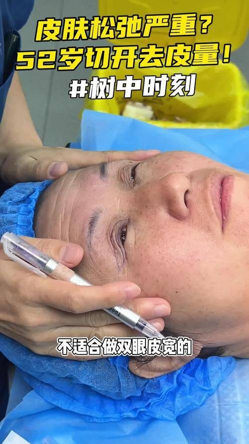 日照烁美医疗美容诊所特色项目及技术优势