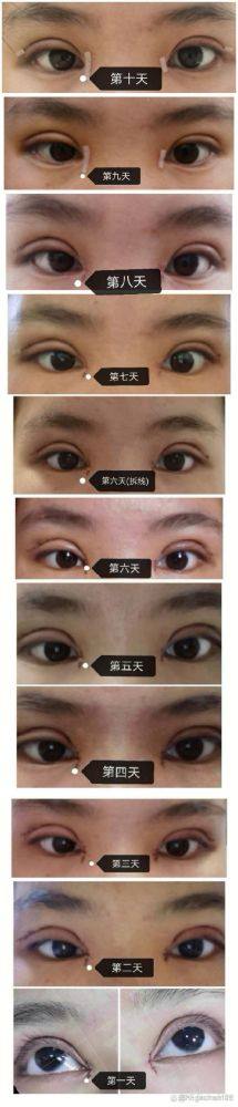 嵊州市妇幼保健院整形美容科真人口碑评价怎么样？