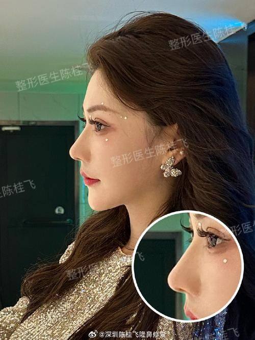 日照烁美医疗美容诊所真人口碑评价怎么样？