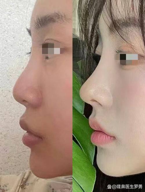 桂林容嫣医疗美容详细的预约挂号方式及流程