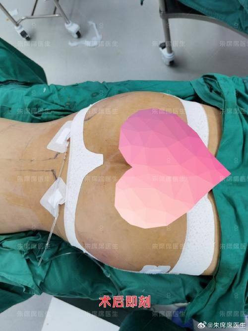 深圳恒生医院整形美容中 心收费价格表/收费标准