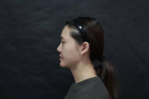 日照烁美医疗美容诊所收费价格表/收费标准