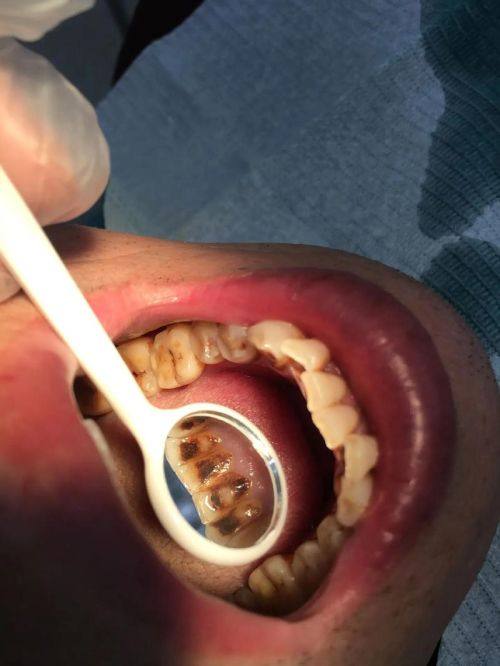 陕西榆林灵星口腔详细的预约挂号方式及流程