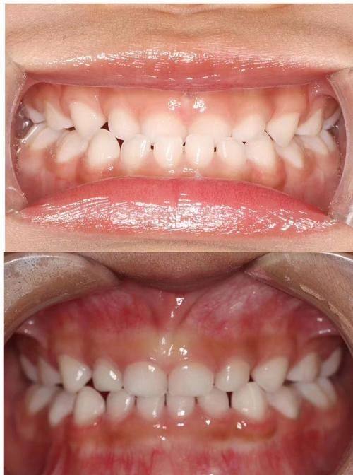 江苏徐州荣之盛口腔详细的预约挂号方式及流程