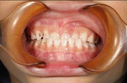 江苏徐州荣之盛口腔真人口碑评价怎么样?