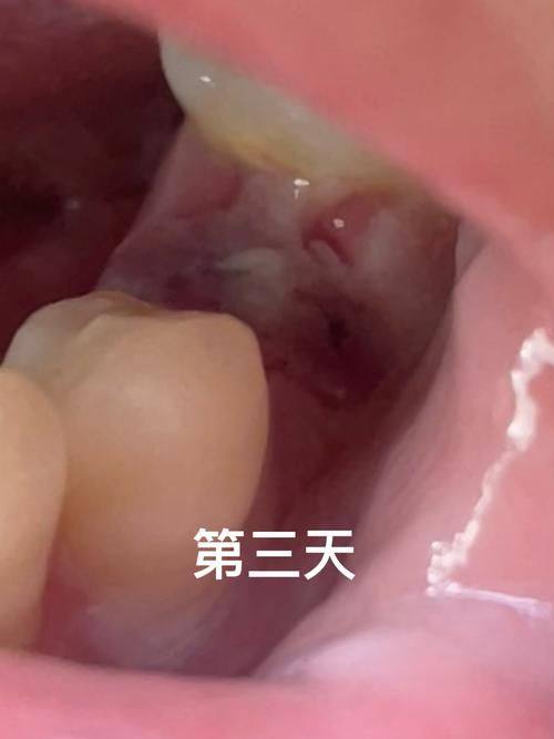 陕西榆林灵星口腔医生团队实力强大及骨干医生简介