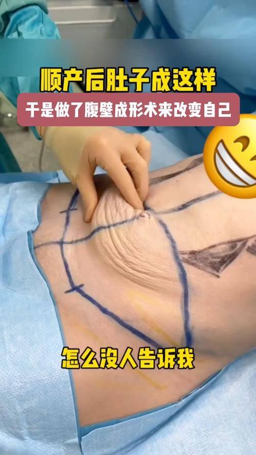 深圳恒生医院整形美容中 心真人口碑评价怎么样？