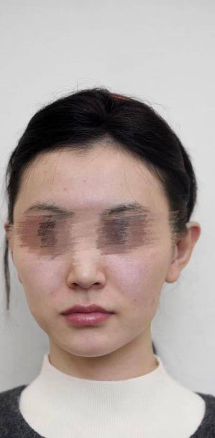 包头赵云庆医疗美容诊所详细的预约挂号方式及流程