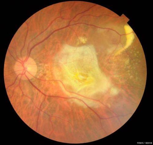 临沂润视眼科医院是正规医院吗?