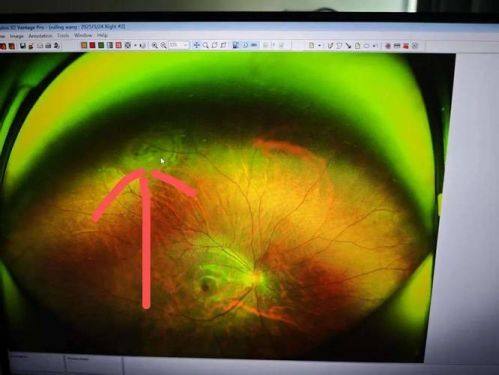 佛山华厦眼科医院医生团队实力强大及骨干医生简介