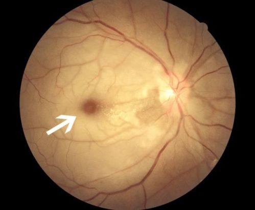 北京大学滨海医院眼科详细的预约挂号方式及流程