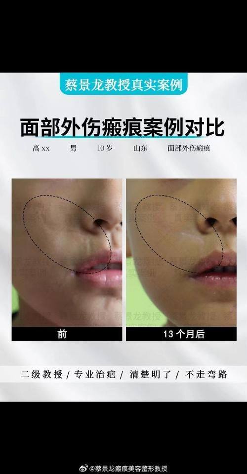 深圳恒生医院整形美容中 心详细的预约挂号方式及流程