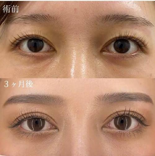 南昌臻爱医疗美容是正规医院吗？