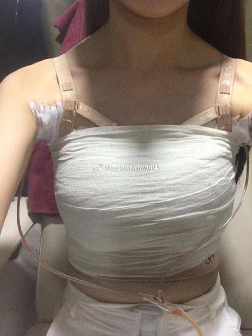 桂林容嫣医疗美容真人口碑评价怎么样?